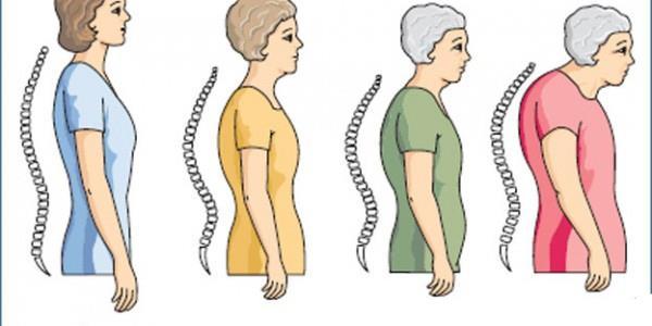 Dünya Osteoporoz Günü - Kırıkkale Haber, Son Dakika Kırıkkale Haberleri
