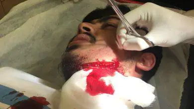 Ne bakıyorsun tartışması kanlı bitti - Kırıkkale Haber, Son Dakika Kırıkkale Haberleri Ne bakıyorsun tartışması kanlı bitti - Kırıkkale Haber, Son Dakika Kırıkkale Haberleri