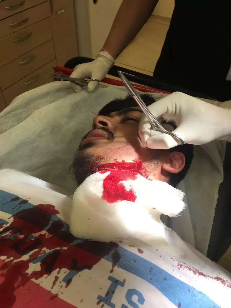 Ne bakıyorsun tartışması kanlı bitti - Kırıkkale Haber, Son Dakika Kırıkkale Haberleri