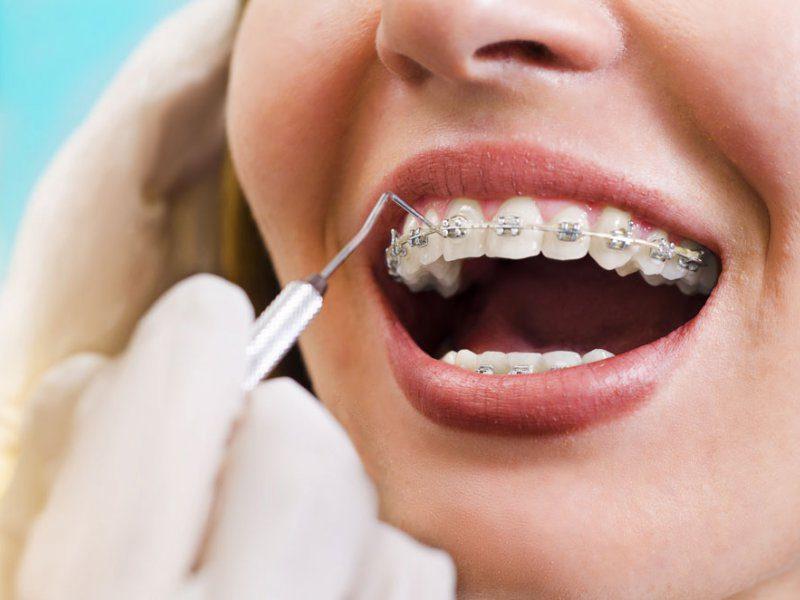Diş Kliniğinde Sunulan Hizmetler - Kırıkkale Haber, Son Dakika Kırıkkale Haberleri