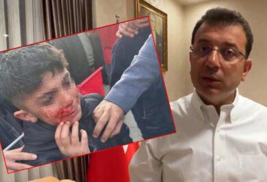 Eldemir'den Erzurum'da Yaşananlara Tepki - Kırıkkale Haber, Son Dakika Kırıkkale Haberleri Eldemir'den Erzurum'da Yaşananlara Tepki - Kırıkkale Haber, Son Dakika Kırıkkale Haberleri
